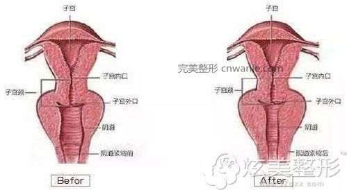 引导紧缩原理图韩国好手艺